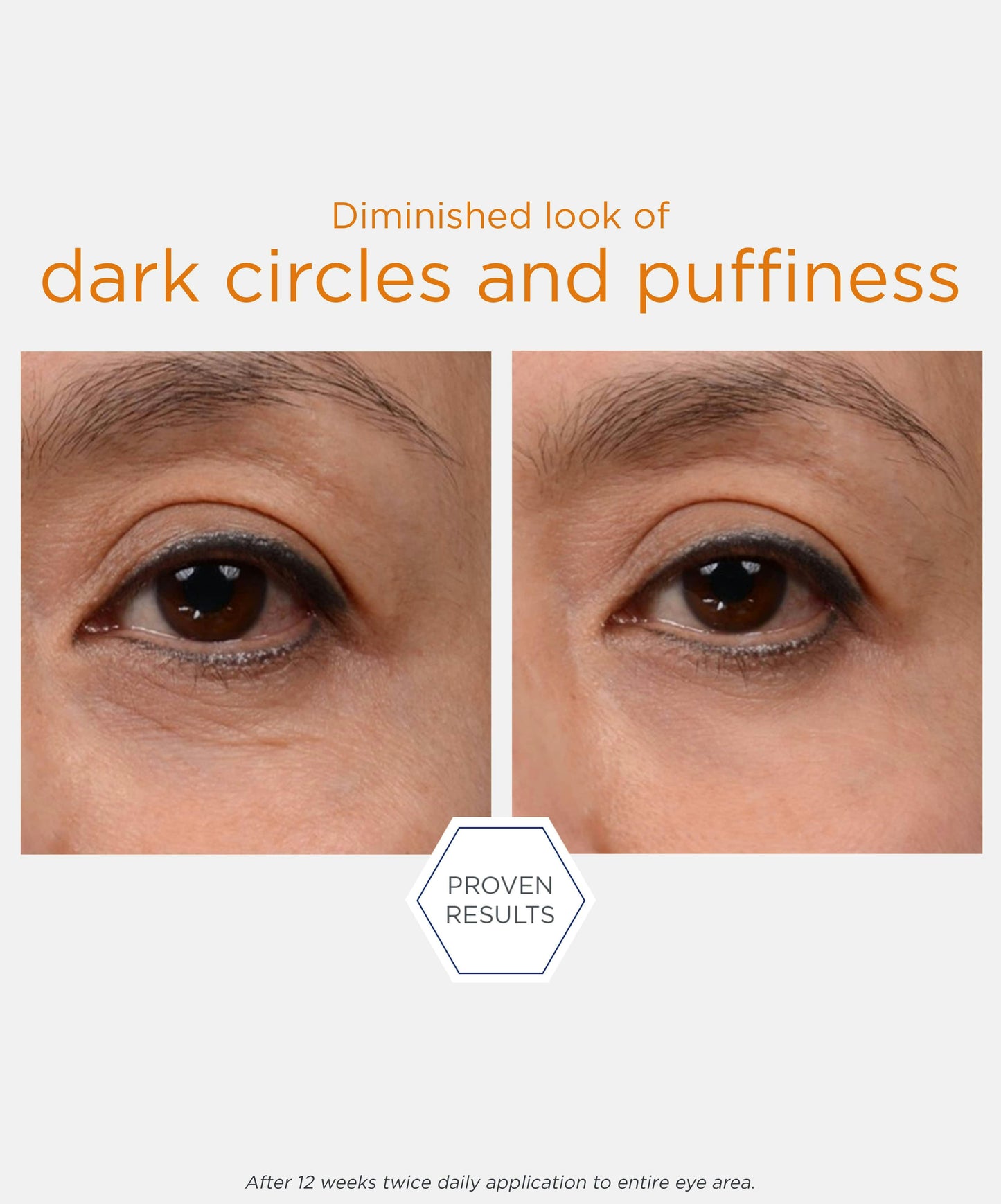 Brightening Eye Cream