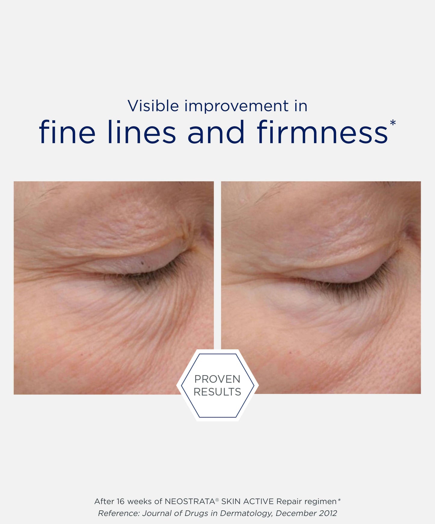 Intensive Eye Therapy