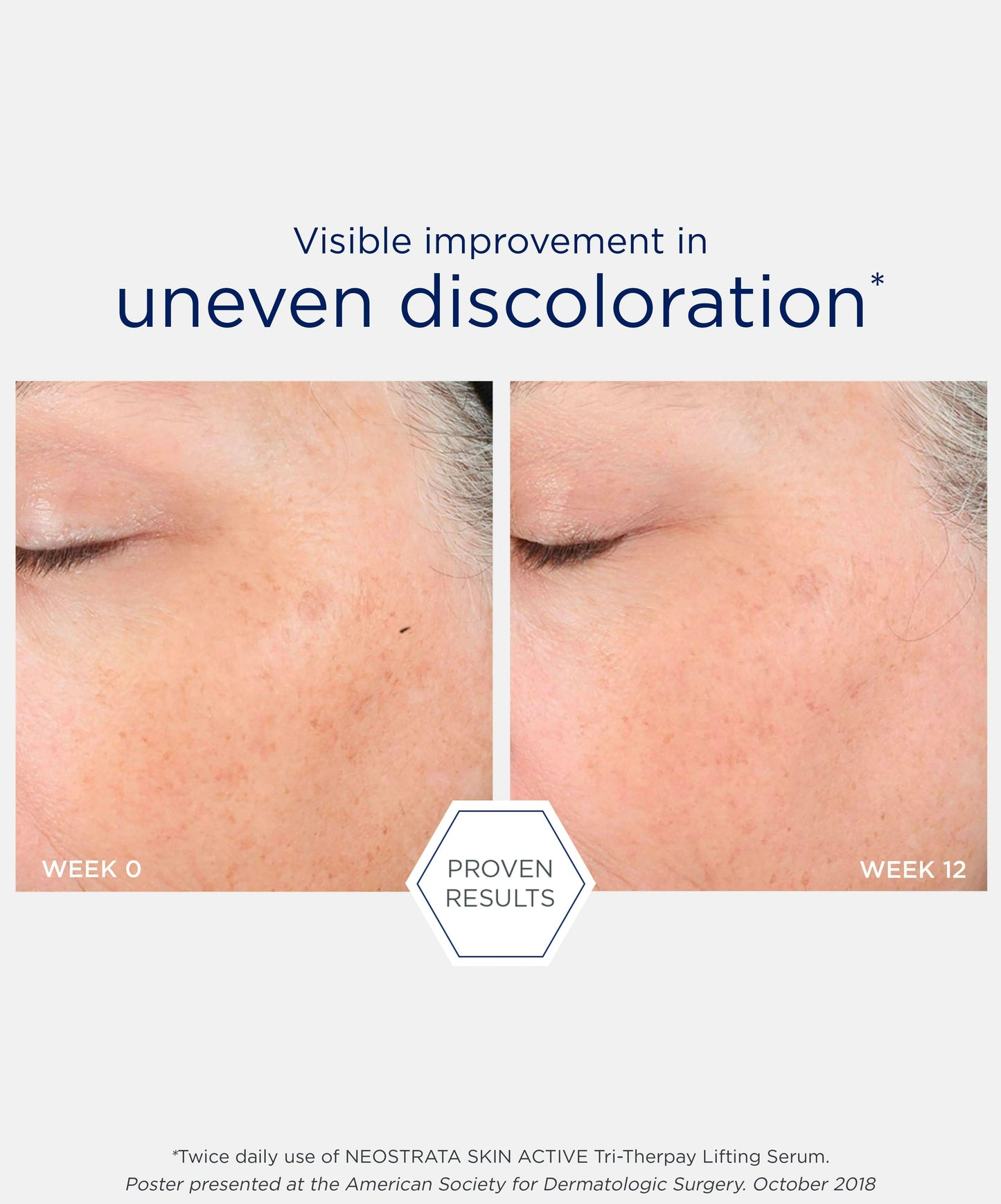 Tri-Therapy Lifting Serum