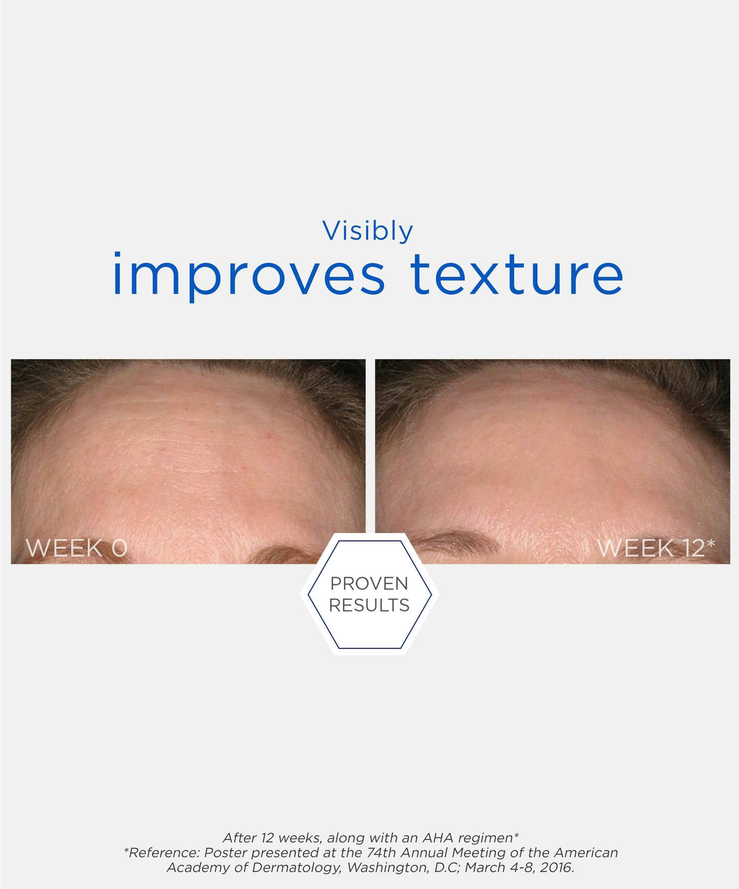 Smooth Surface Glycolic Chemical Peel