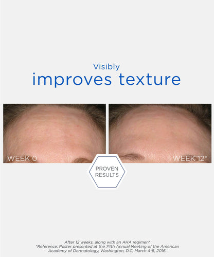 Smooth Surface Glycolic Chemical Peel