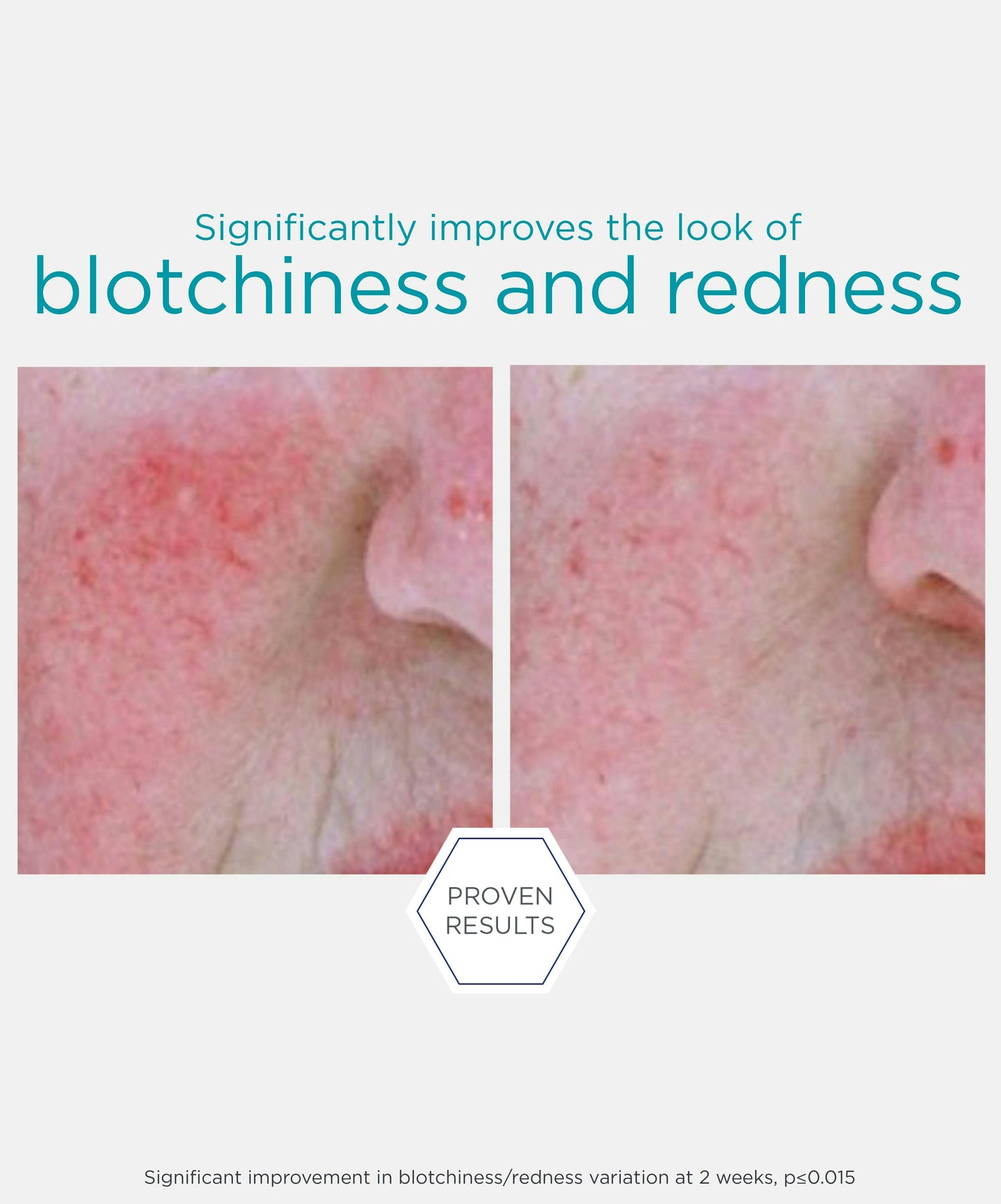 Redness Neutralizing Serum