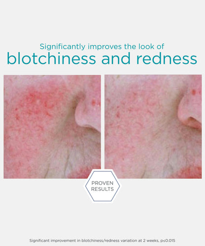 Redness Neutralizing Serum