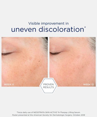 Tri-Therapy Lifting Serum