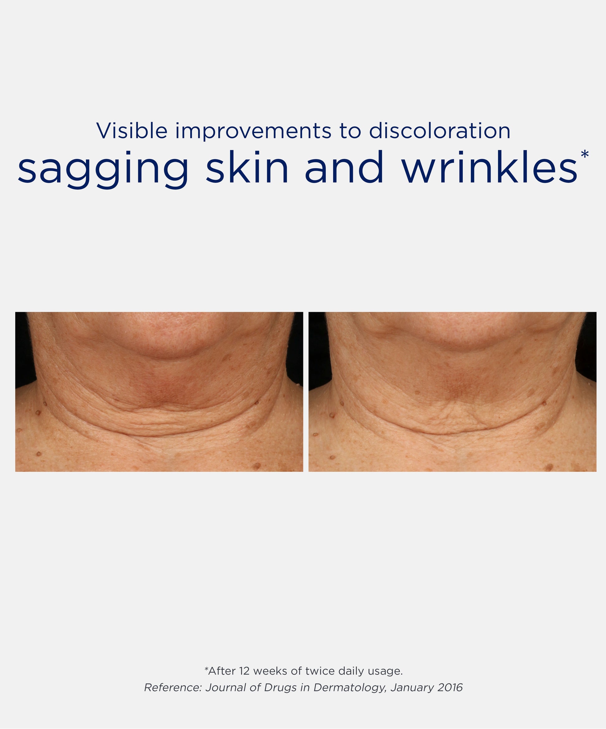 Triple Firming Neck Cream with MicroDiPeptide229®